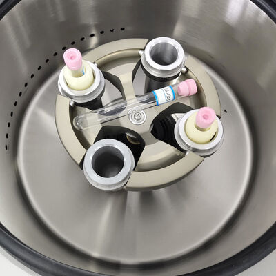 PRP Centrifuge Machine with 5000rpm Max Speed 3555xg RCF and LCD Display for Laboratory Use