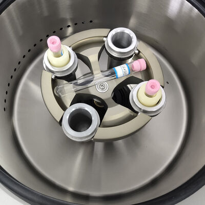 PRP Centrifuge with 5000rpm Max Speed, 3555xg Max RCF, and LCD Display for Clinical Medicine